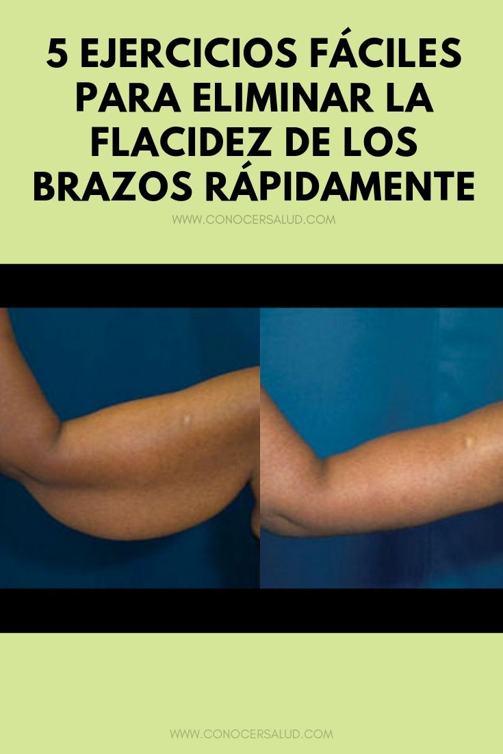 5 Ejercicios Fáciles Para Eliminar La Flacidez De Los Brazos Rápidamente Conocer Salud 8785