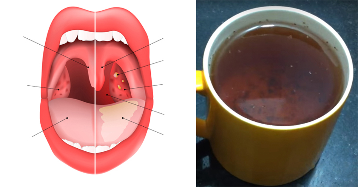 Alexandria endoscopic mouth tour uvula tonsils