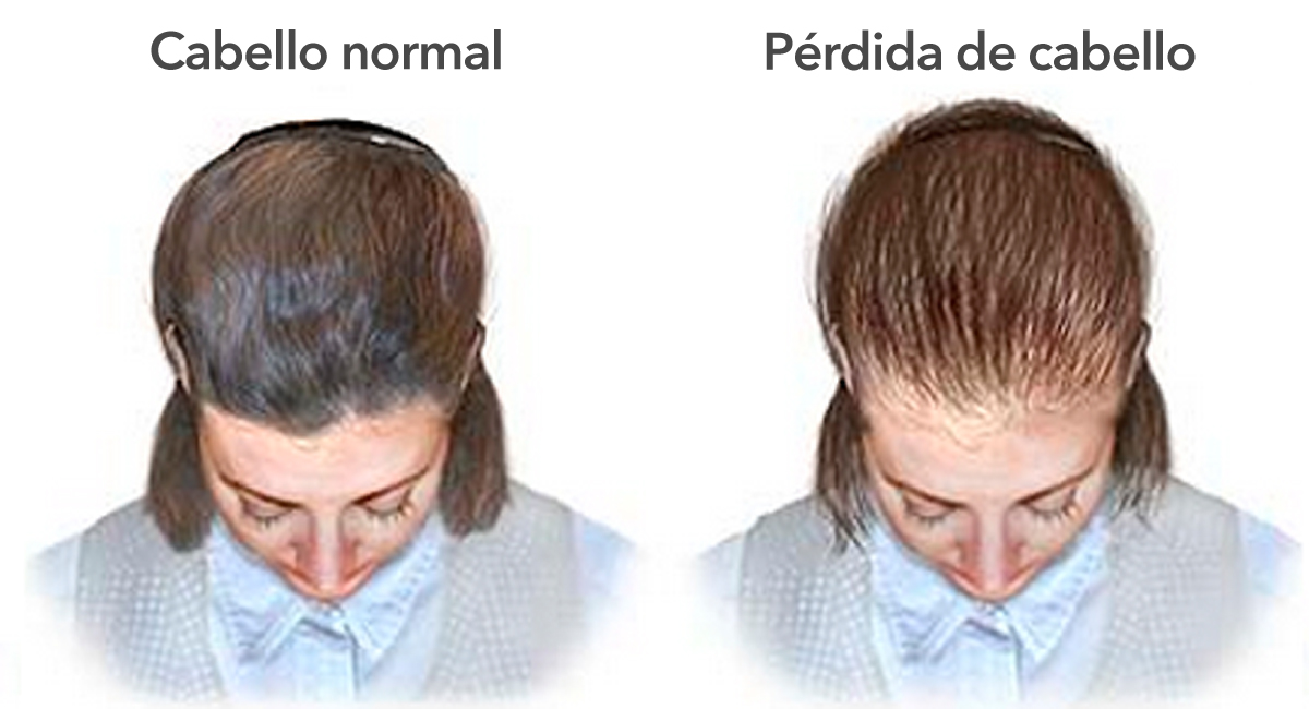 11 Razones Por Las Que Tu Cabello Deja De Crecer Y Se Vuelve Delgado ...