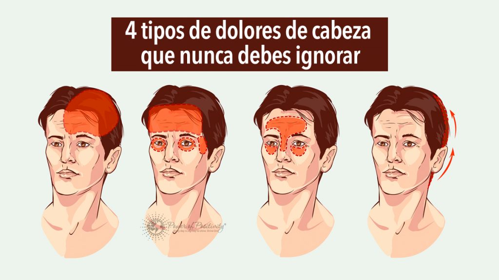 4 tipos de dolores de cabeza que nunca debes ignorar