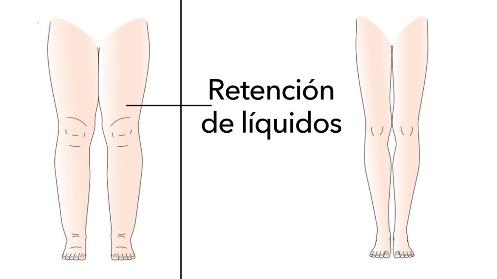 5 Razones por las que su cuerpo retiene líquidos (y cómo evitarlo)