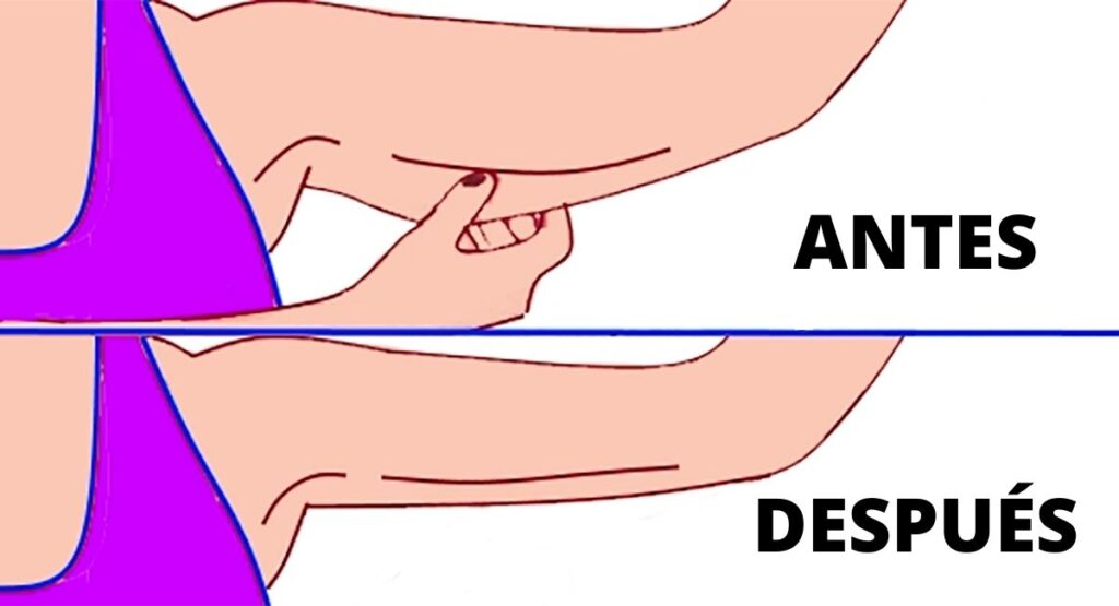 6 Sencillos Ejercicios Para Deshacerse De Los Brazos Flacidos 0119